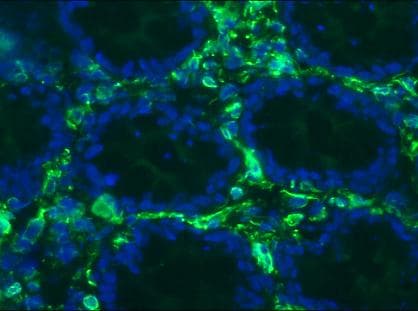IHC-plus™ Monoclonal Mouse anti-Human Vimentin Antibody (clone RV203, IHC, WB)