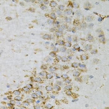 PDPK1 / PDK1 Antibody