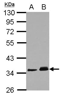 PPM1J Antibody