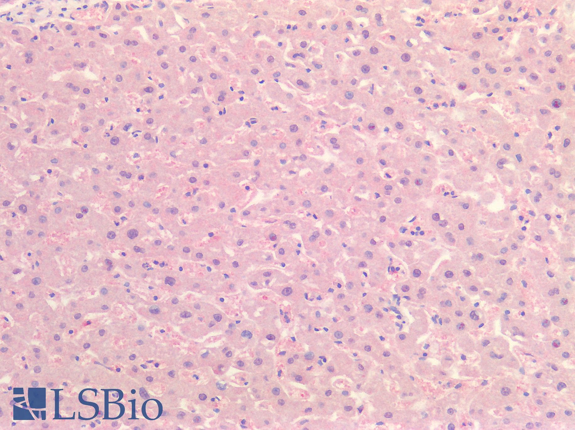 FGL1 / Hepassocin Antibody (aa23-314)