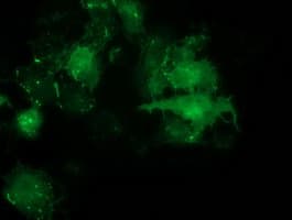 PDLIM2 / SLIM Antibody (clone OTI1D12)