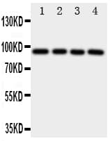 AHR Antibody (aa34-48)