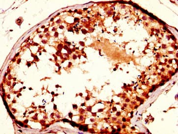 Polyclonal Rabbit anti-Human NUP93 Antibody (IHC)