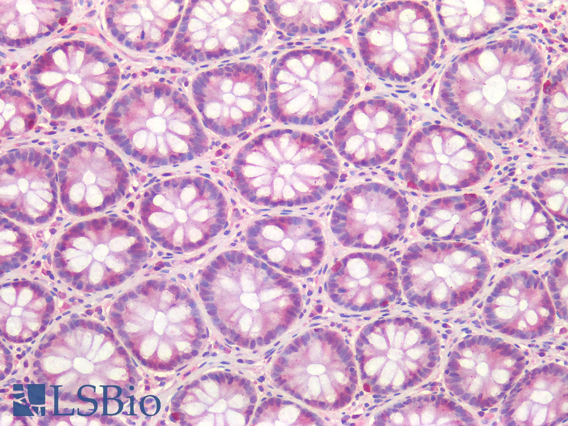 IHC-plus™ ALK2 / ACVR1 Antibody