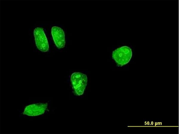 MAP2K7 / MEK7 Antibody (clone 2G5)