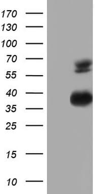 MSLN / Mesothelin Antibody (aa270-493, clone OTI1G8)