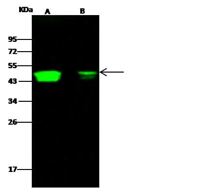 Monoclonal Rabbit anti-Human CCR1 Antibody (clone 002, Preservative Free, WB)