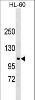 NDST3 Antibody (aa809-836)