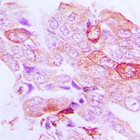 Polyclonal Rabbit anti-Human STK33 Antibody (N-Terminus, IHC, WB)