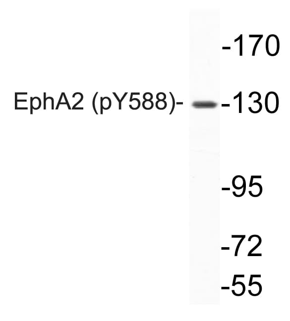 Polyclonal Rabbit anti-Human EPHA2 / EPH Receptor A2 Antibody (phospho-Tyr588, WB)