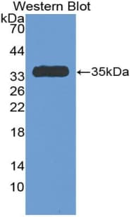 Antithrombin Antibody (aa150-426, APC)