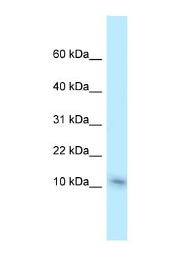 NME1 / NM23 Antibody (aa82-131)