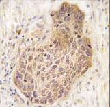 RICK / RIP2 Antibody (aa458-488)