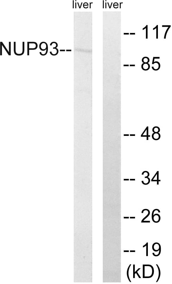 Polyclonal Rabbit anti-Human NUP93 Antibody (aa221-270, WB)
