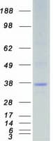 Human STK16 Protein (Recombinant Myc-DDK (Flag))