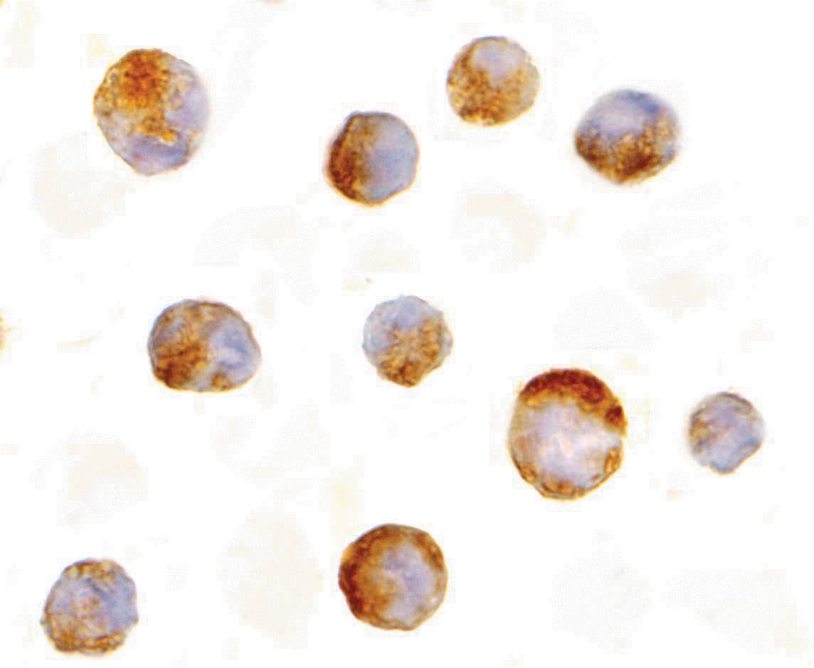 MCL1 / MCL 1 Antibody