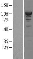 ACTN4 Protein (Over-Expression Lysate Myc-DDK (Flag))