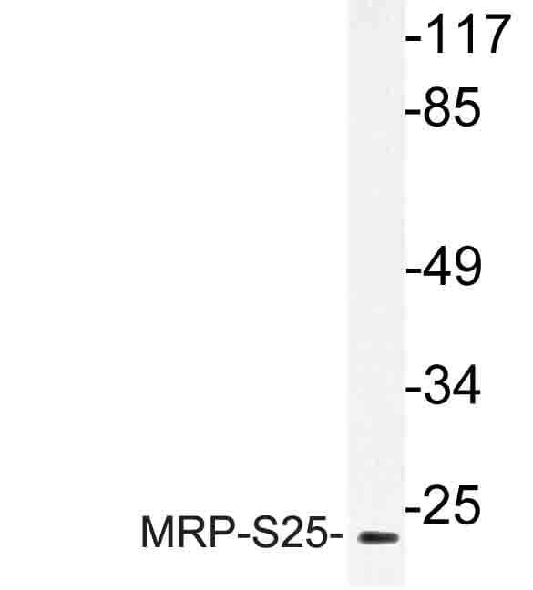 MRPS25 Antibody (Lyl168)