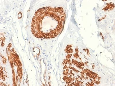 CALD1 / Caldesmon Antibody (clone rCALD1/820, Azide-free, Carrier-free)