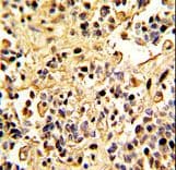 Polyclonal Rabbit anti-Human MME / CD10 Antibody (aa506-534, IHC, WB)