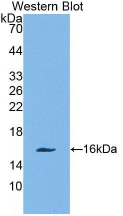 CLC Antibody (clone C1, PE)