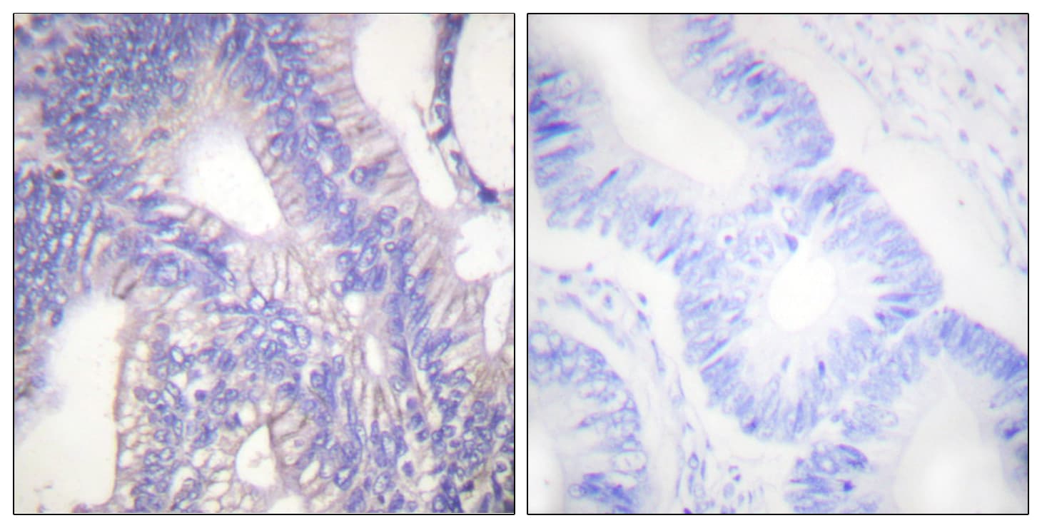 LYN Antibody (aa463-512)