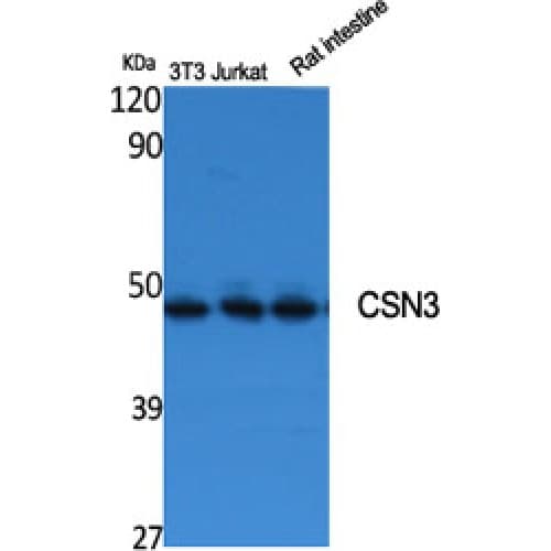 COPS3 / CSN3 Antibody (340-420 aa, Internal)