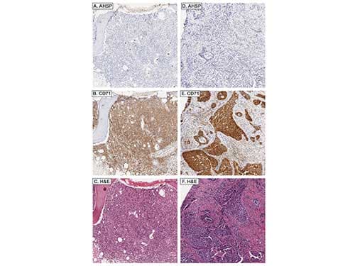 AHSP / EDRF Antibody (Liquid)