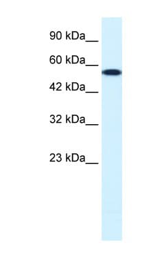 CHEK1 / CHK1 Antibody (aa192-241)