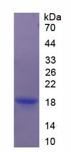 Rat Adiponectin Protein (Recombinant His)