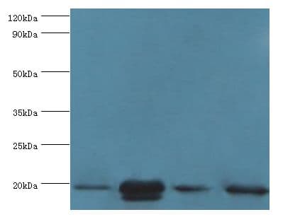 CRYAB / Alpha B Crystallin Antibody (aa1-175)