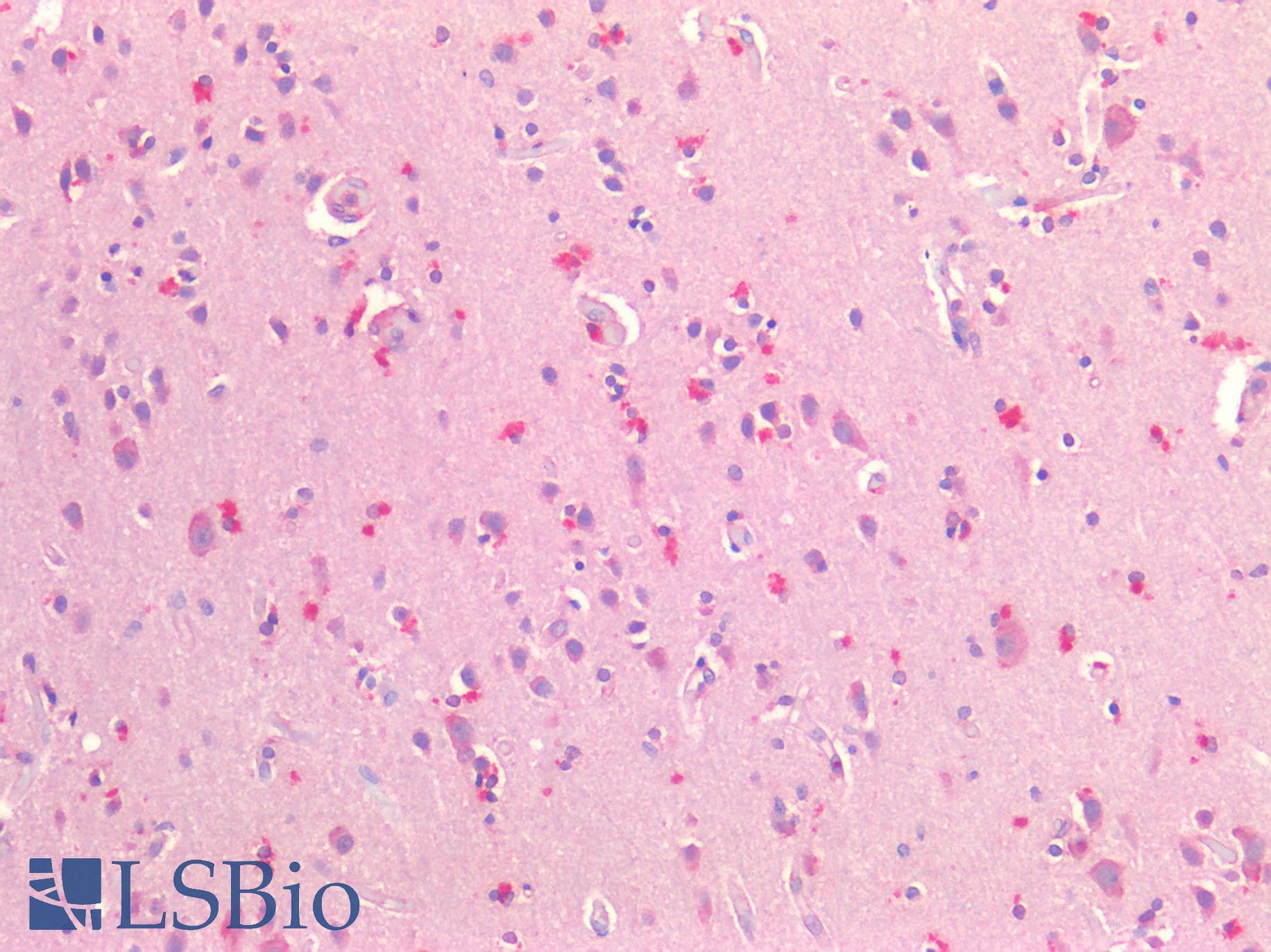 IHC-plus™ CSMD1 Antibody