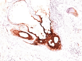 KRT17 / CK17 / Cytokeratin 17 Antibody (clone SPM560)