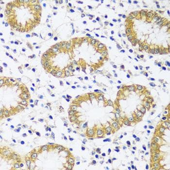 CADPS Antibody
