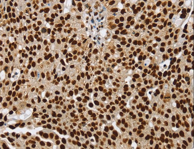 SSB / La Antibody