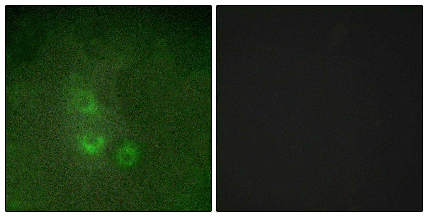 FRK Antibody