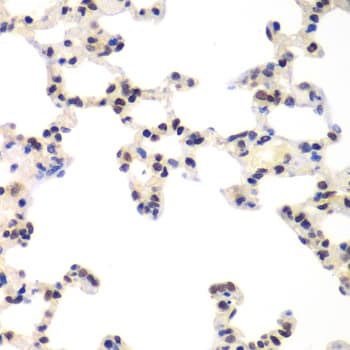 RNF2 / RING2 / RING1B Antibody