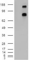PTCH1 / Patched 1 Antibody (clone OTI5C7)
