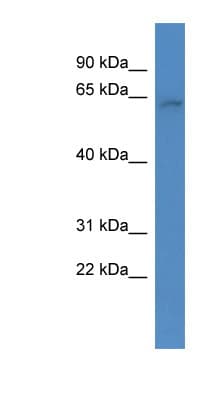 ARID3B Antibody (aa426-475)