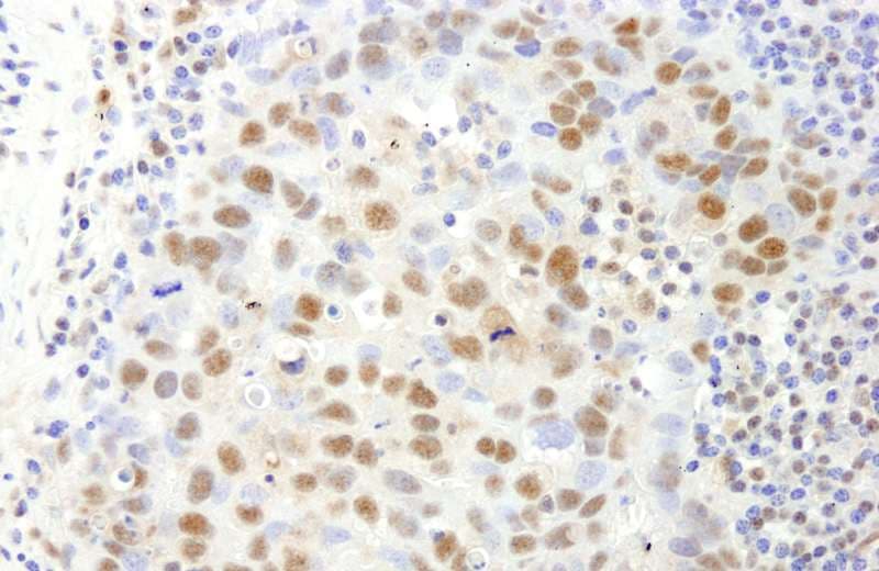SAFB1 / SAFB Antibody (aa875-C-term)