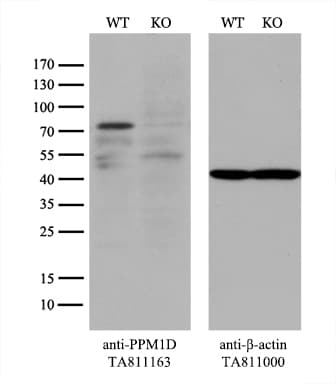 PPM1D / WIP1 Antibody (aa1-375, clone OTI4H3)