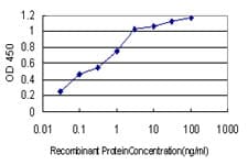 IHC-plus™ Monoclonal Mouse anti-Human AKR1B10 Antibody (clone 1A6, IHC, IF, WB)