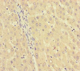 GK / Glycerol Kinase Antibody