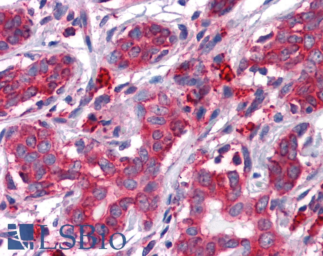 IHC-plus™ Monoclonal Mouse anti-Human HSPA5 / GRP78 / BiP Antibody (clone 4E3, aa525-628, IHC, WB)