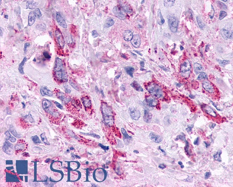 PathPlus™ Polyclonal Rabbit anti-Human GPBAR1 / TGR5 Antibody (C-Terminus, IHC)