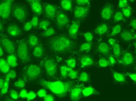 Polyclonal Rabbit anti-Human TSEN2 Antibody (IHC, IF, WB)