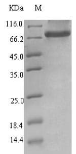 Human Endogenous Retrovirus HERV-K10 putative protease Protein (Recombinant 6His-SUMO, N-terminus)
