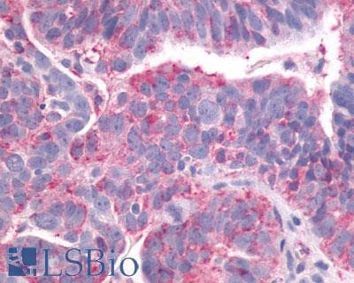 PathPlus™ LPAR4 / GPR23 Antibody (N-Terminus)