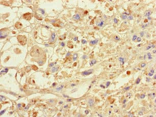 Polyclonal Rabbit anti-Human SPAG9 Antibody (IHC, IF)