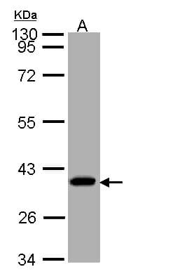 SUCLG1 / GALPHA Antibody (aa1-346)
